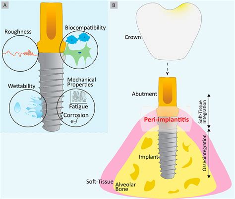  Xylitol: Biomateriale Rivoluzionario per Impianti Dentali di Ultima Generazione!